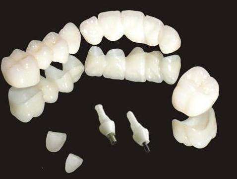 MIM注射成（chéng）型陶瓷牙